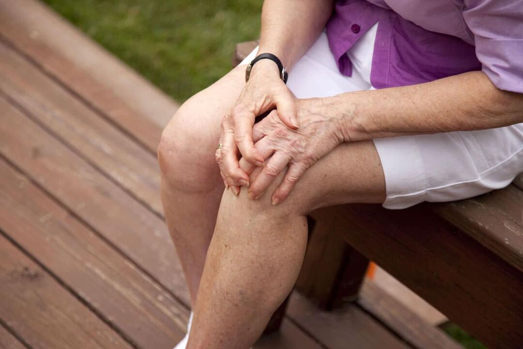 A artrose do xeonllo é común en mulleres maiores