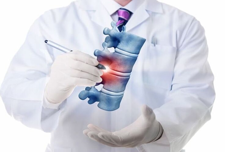 lesións da columna vertebral por osteocondrose torácica