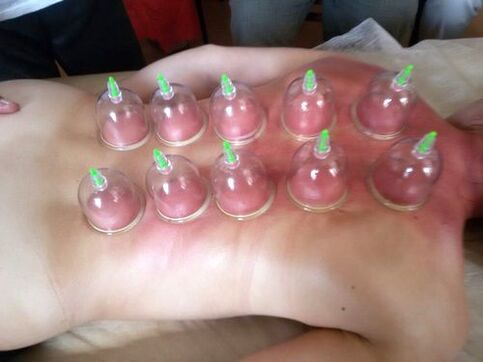 A ventosa ao baleiro é unha excelente forma de tratar a dor lumbar na casa